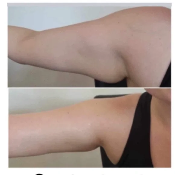 NuSkin Renu Spa in box - Picture 7 of 9